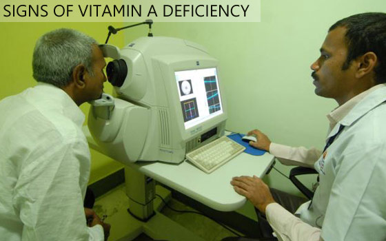 Signs-of-Vitamin-A-Deficiency