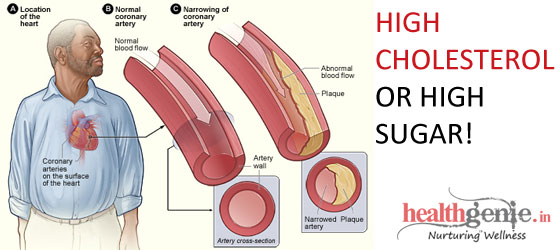 high-cholesterol