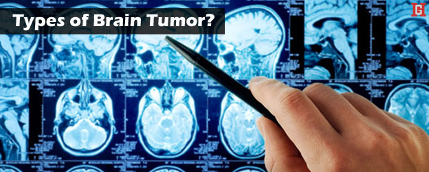 Brain-tumour-type